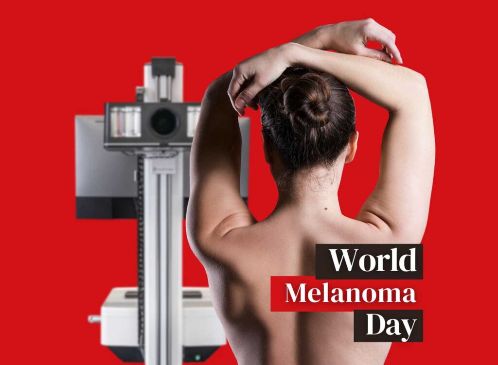Día Mundial del Melanoma: la tecnología aliada en la lucha contra el cáncer de piel