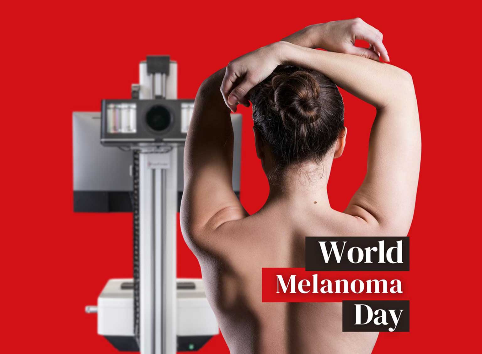 Día Mundial del Melanoma: la tecnología aliada en la lucha contra el cáncer de piel
