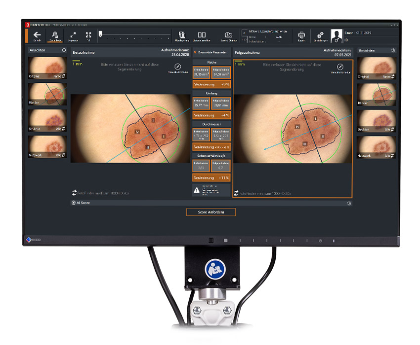 Comparación de imágenes con Moleanalyzer pro