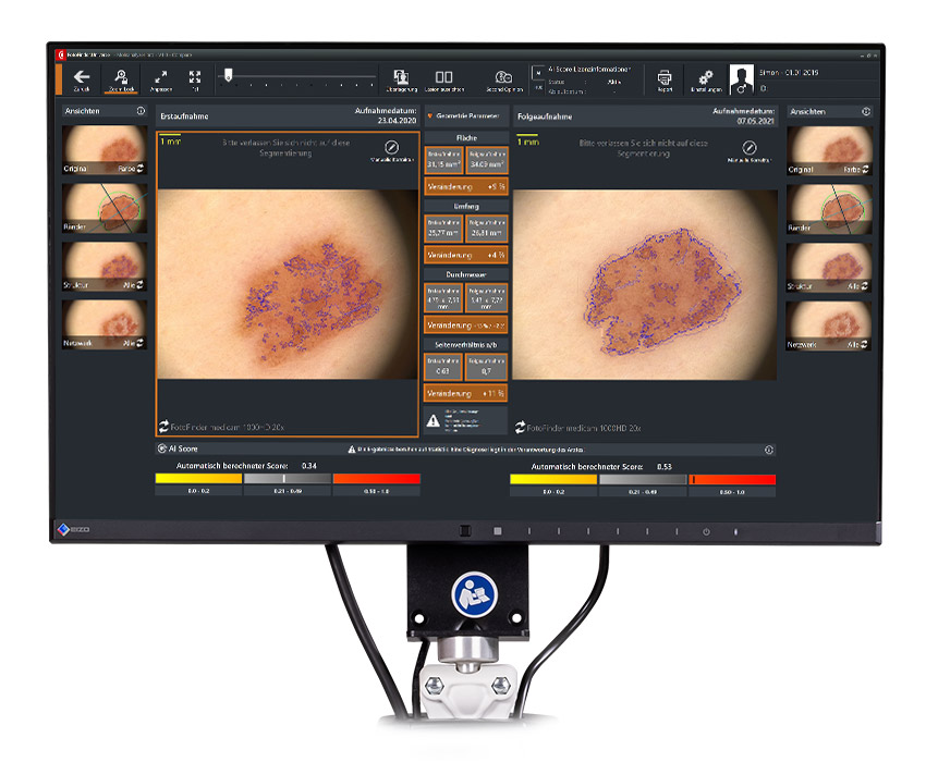 Análisis y segmentación con Moleanalyzer pro